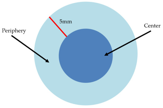 <p>Located on the side or edge.</p>