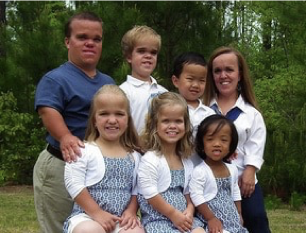 <p>outline achondroplasia </p>