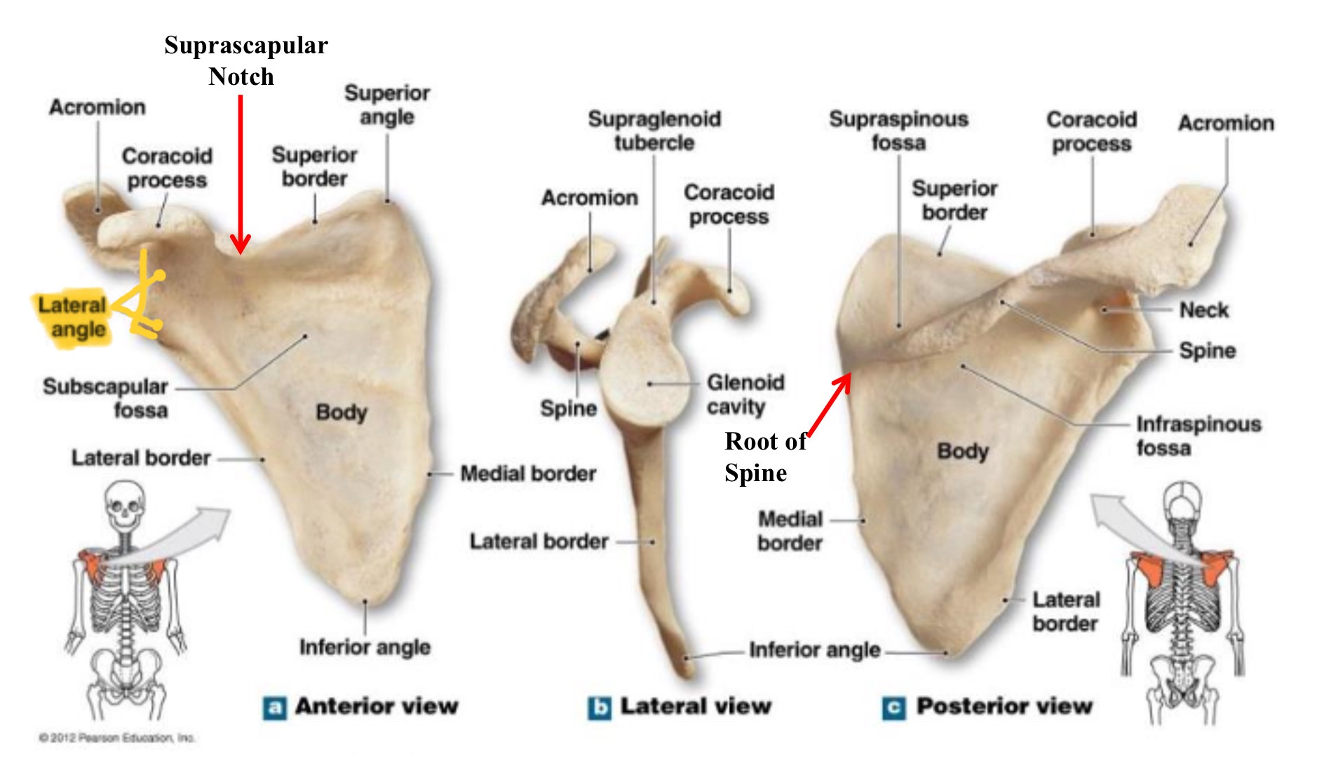 <p>lateral angle of scapula</p>