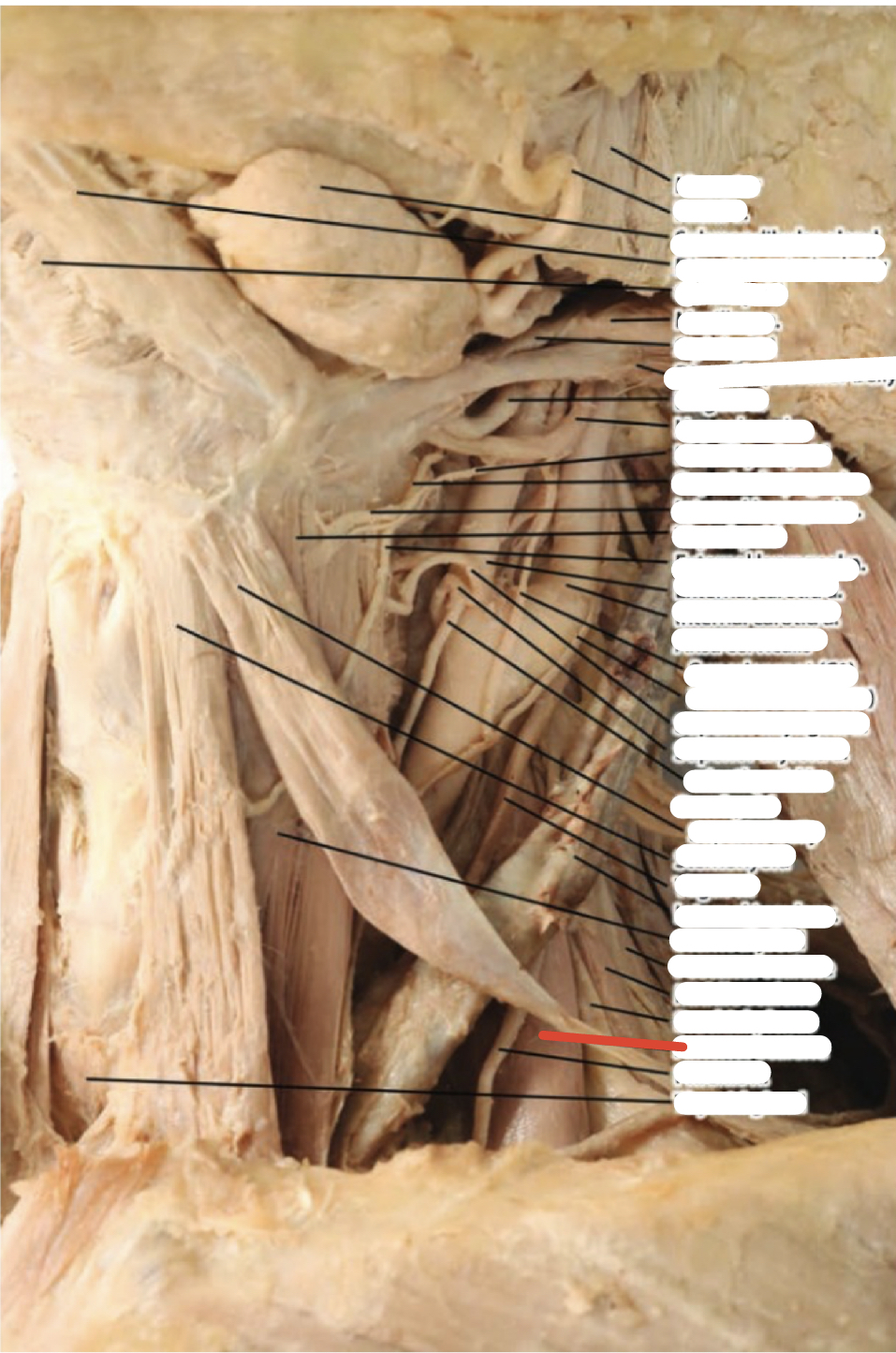 Identify the structure (red line)