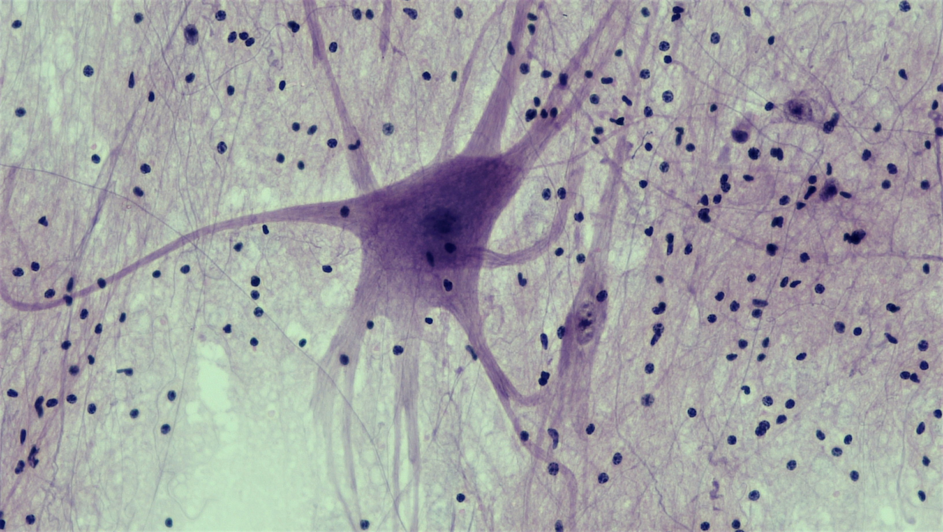 <p>Nervous Tissue</p>