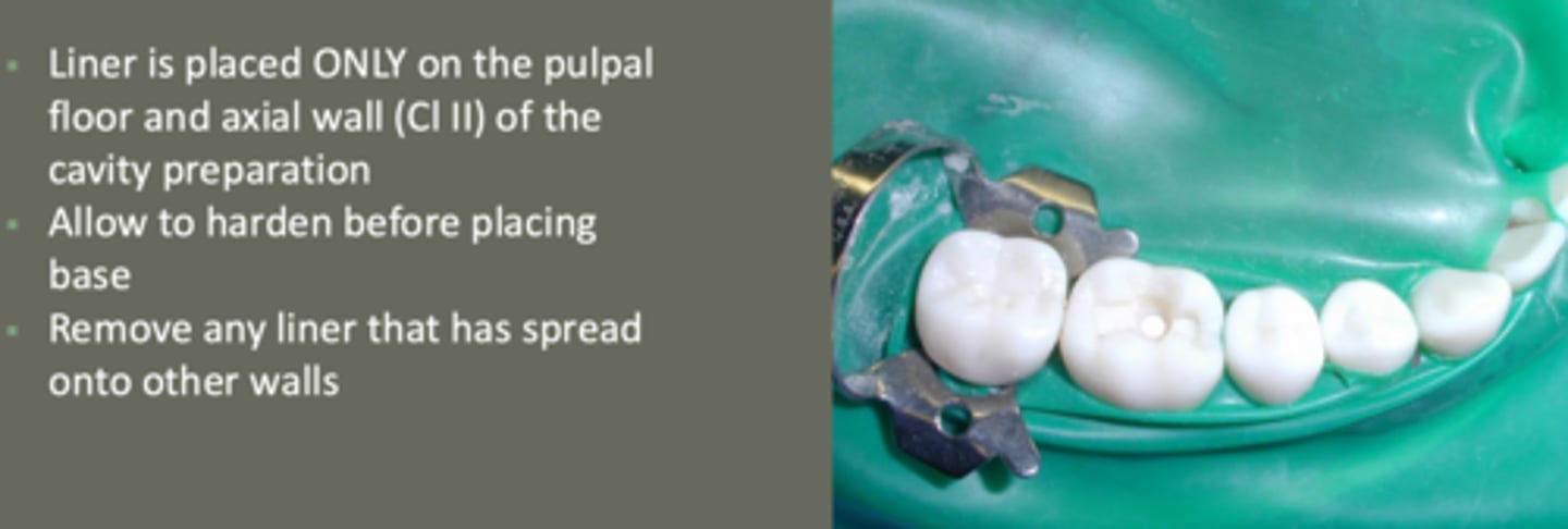<p>- placed only on pulpal floor &amp; axial wall (class II) of prep</p><p>- allow to harden before placing base</p><p>- remove any liner that has spread onto walls</p>