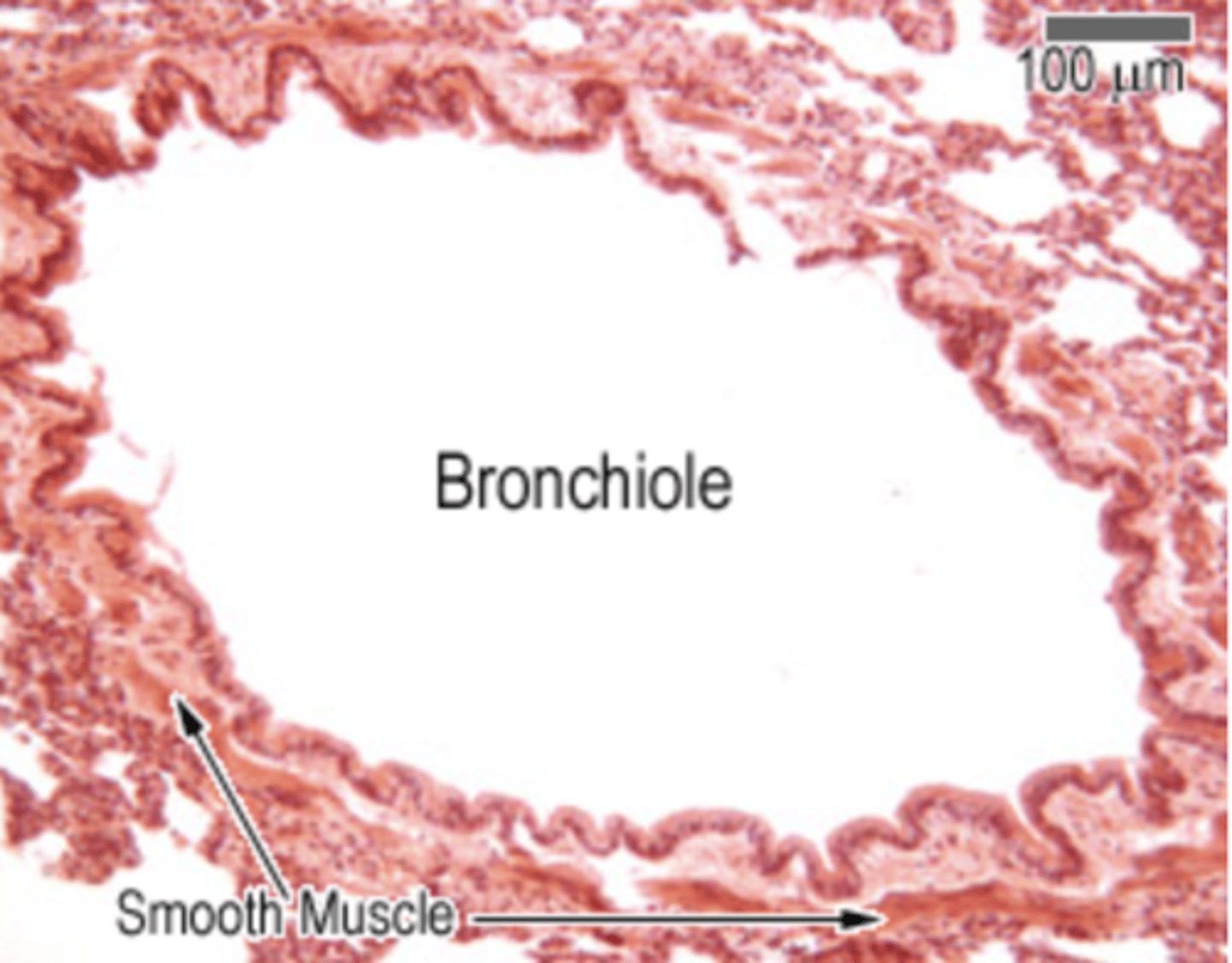 <p>. Mucosa - respiratory epithelium (with increasing number of Clara cells) + lamina propria</p><p>. Muscularis - contains spiral bundles of smooth muscle between the lamina propria and submucosa.</p><p>. Submucosa: loose - dense FECT which may still contain some seromucous glands</p><p>. Muscularis externa - small hyaline cartilage rings (disappearing, being replaced by SM) + smooth muscle connecting the open ends</p><p>. Adventitia - loose FECT anchoring to surrounding tissue</p>