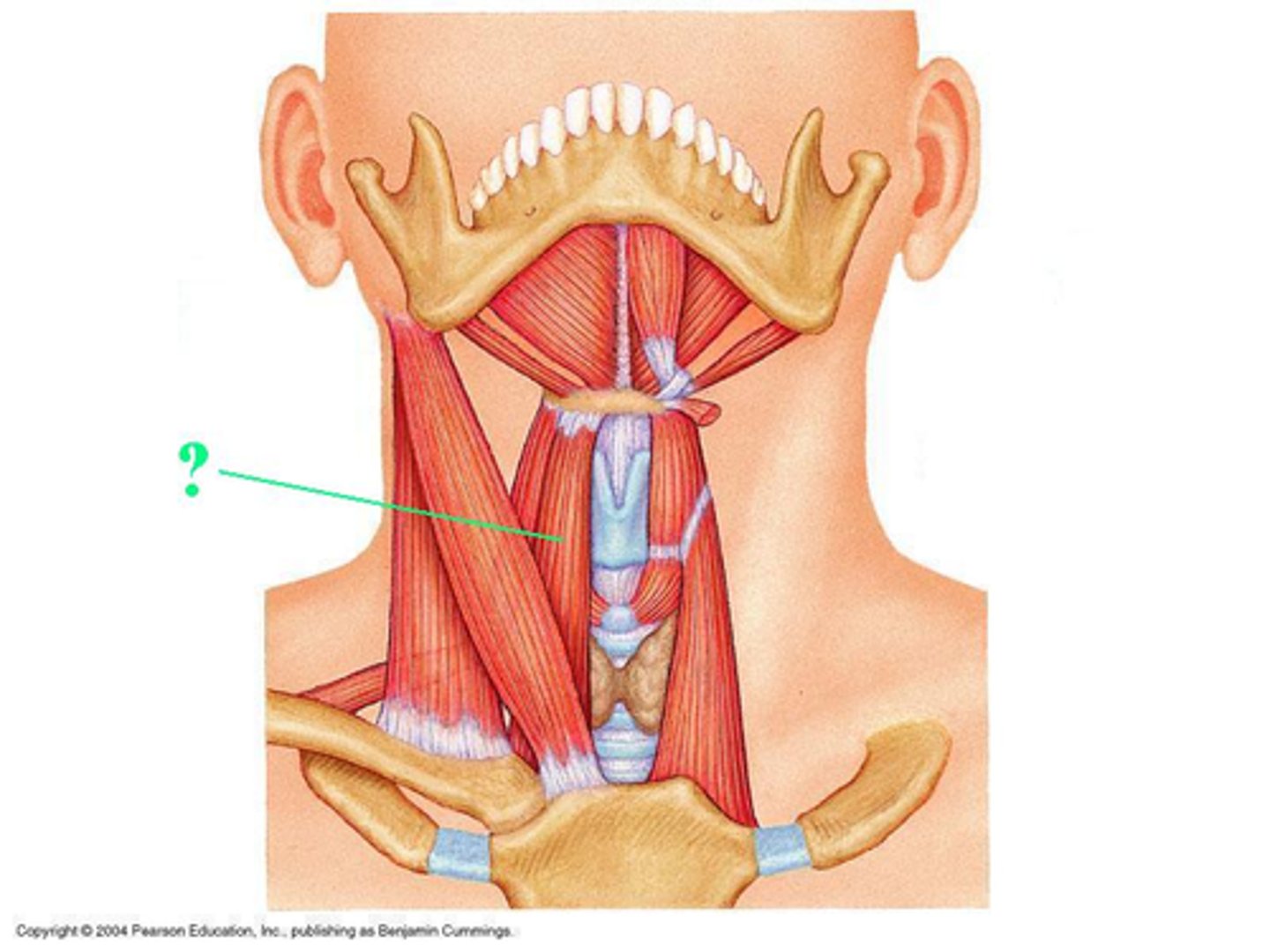 <p>Identify the indicated muscle</p>