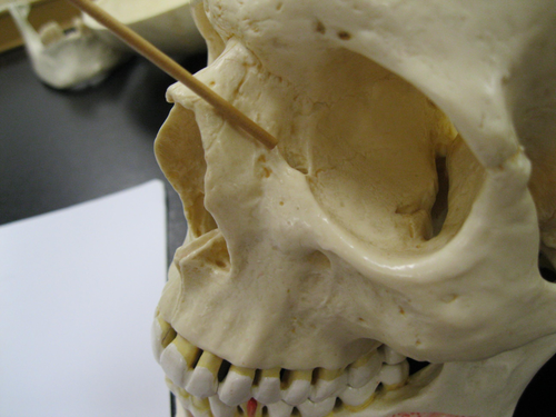 Which bone contains the ANTERIOR lacrimal crest?
