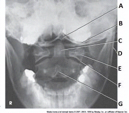 <p><span>What anatomy is labeled with the letter&nbsp;</span><em>C</em><span>&nbsp;in the image below?</span></p>