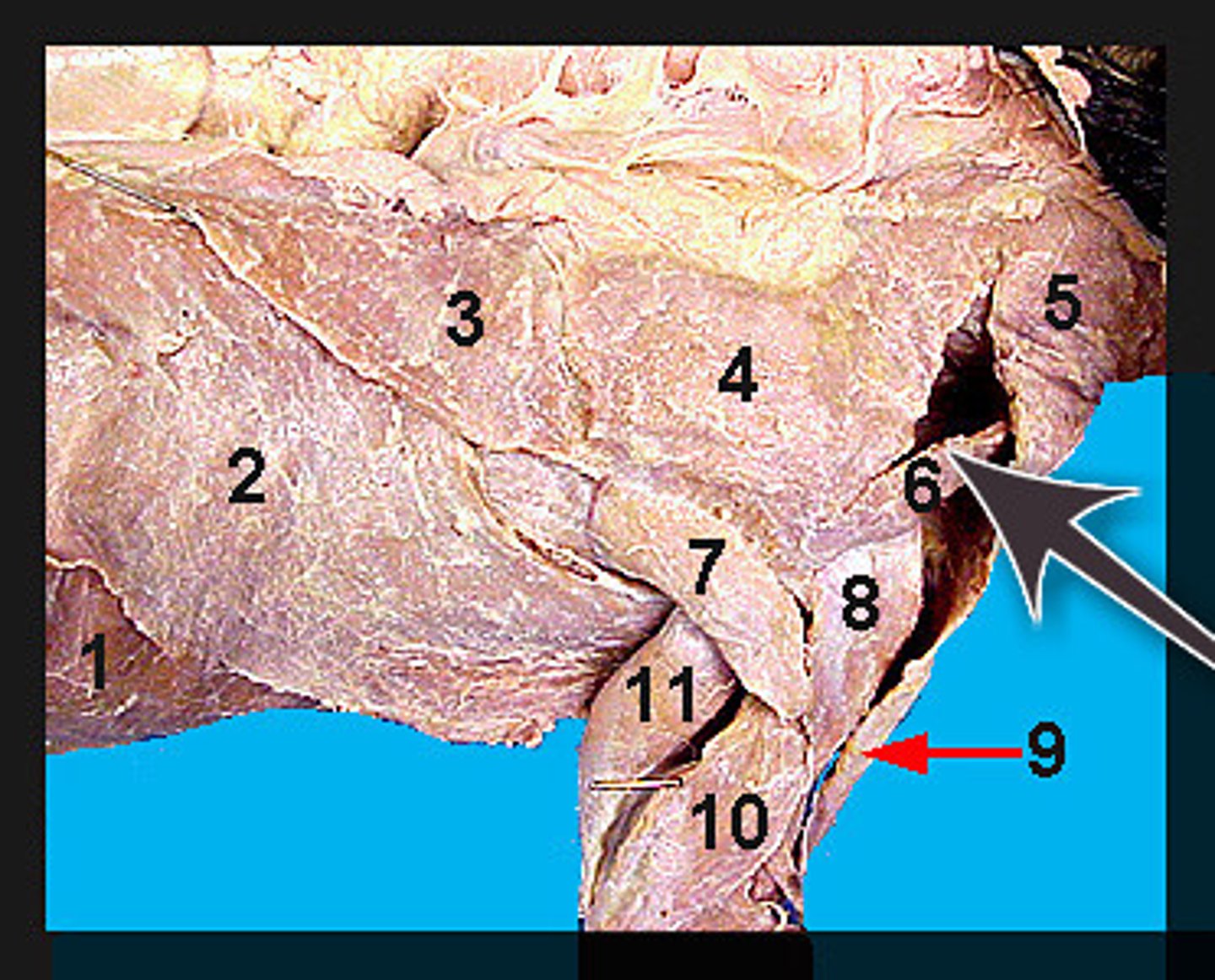 <p>Identify what the brown arrow is pointing to; also labeled number "6"</p>