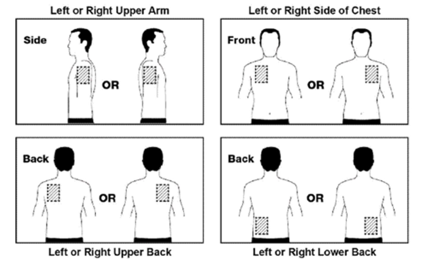 <p>anywhere (chest, back, upper arm) besides the flanks</p>