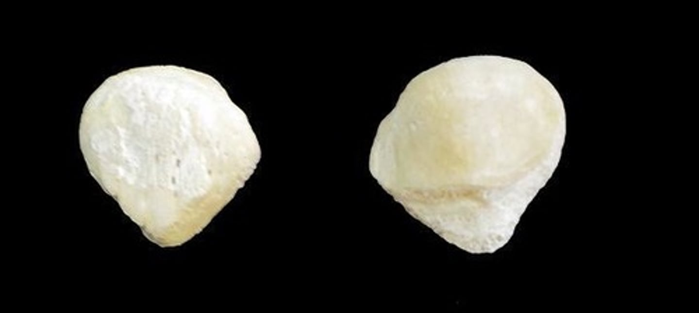 <p>ID bone</p>