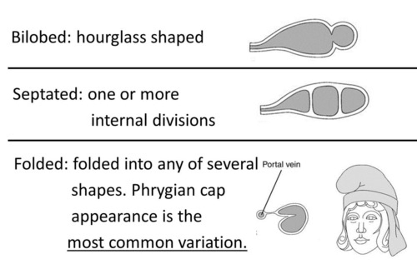 <p>septated</p><p>double GB</p><p>Agenesis</p><p>Hypoplasia</p>