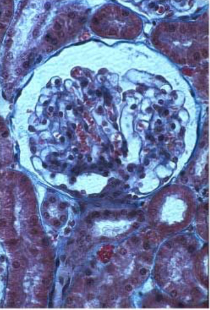 <p>Simple Squamous </p>