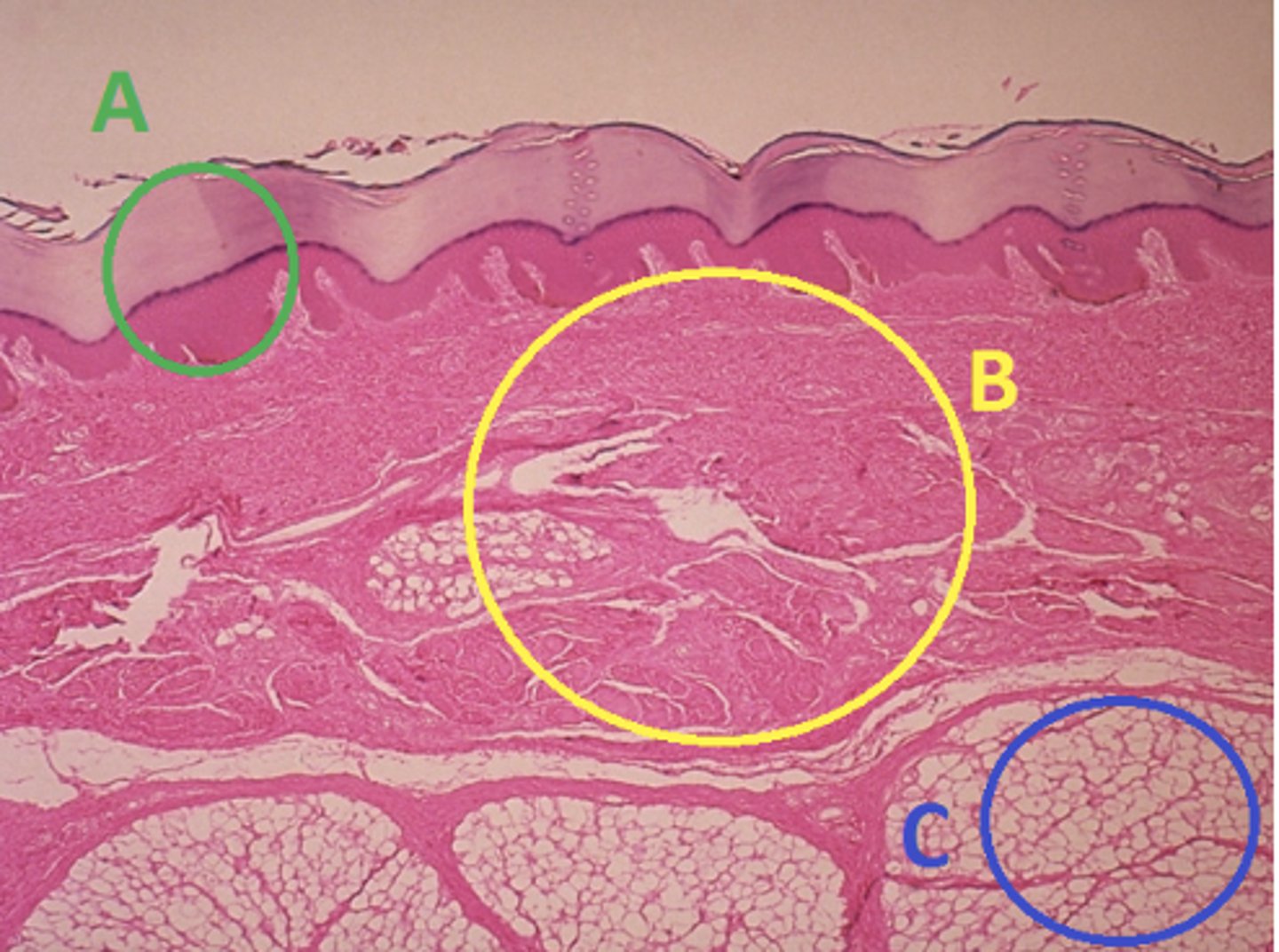 <p>Answer the following questions based on the features indicated in the following image. Which of the four major tissue types is indicated by letter A?</p>