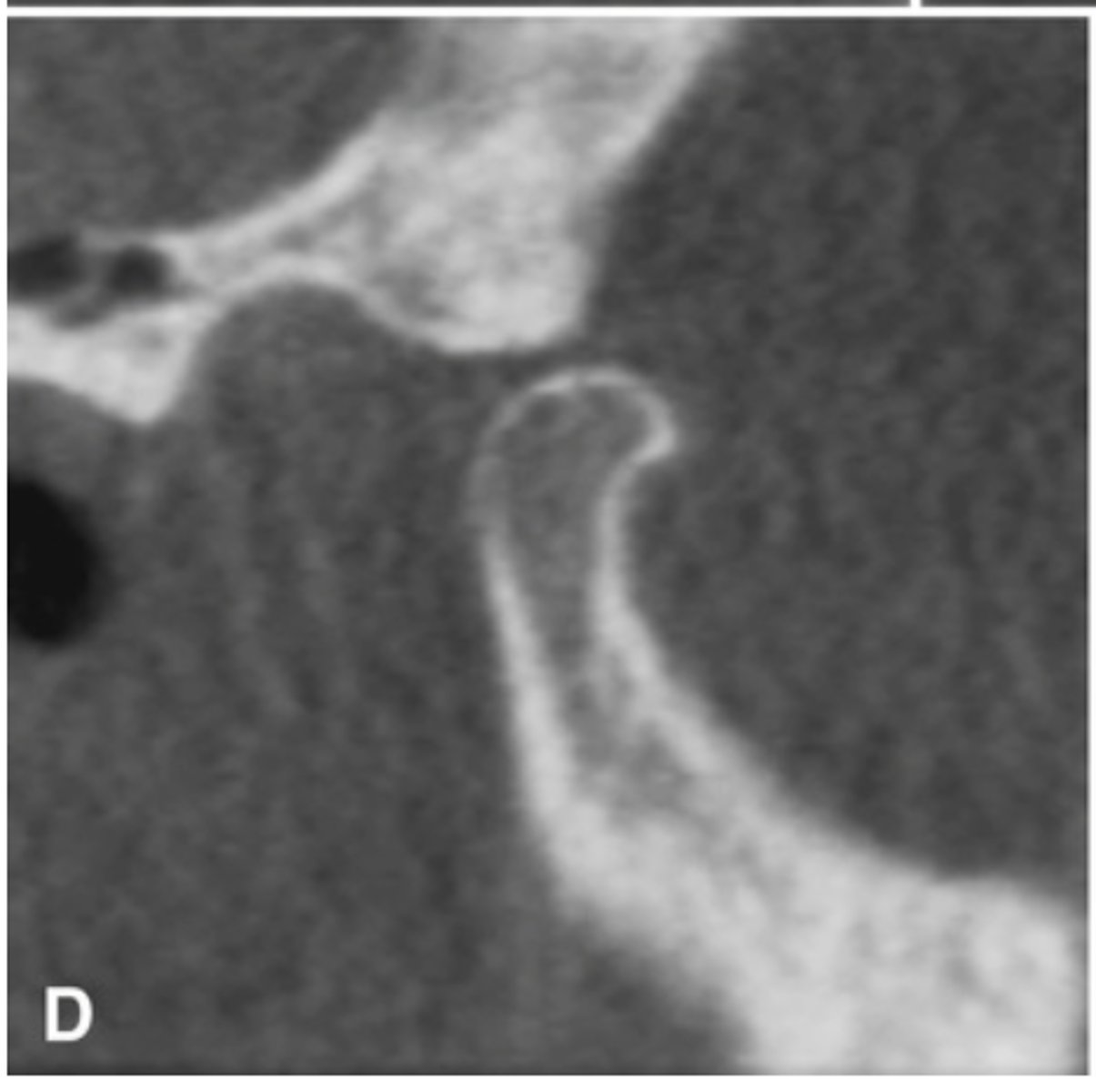 <p>What does the radiograph depict?</p>