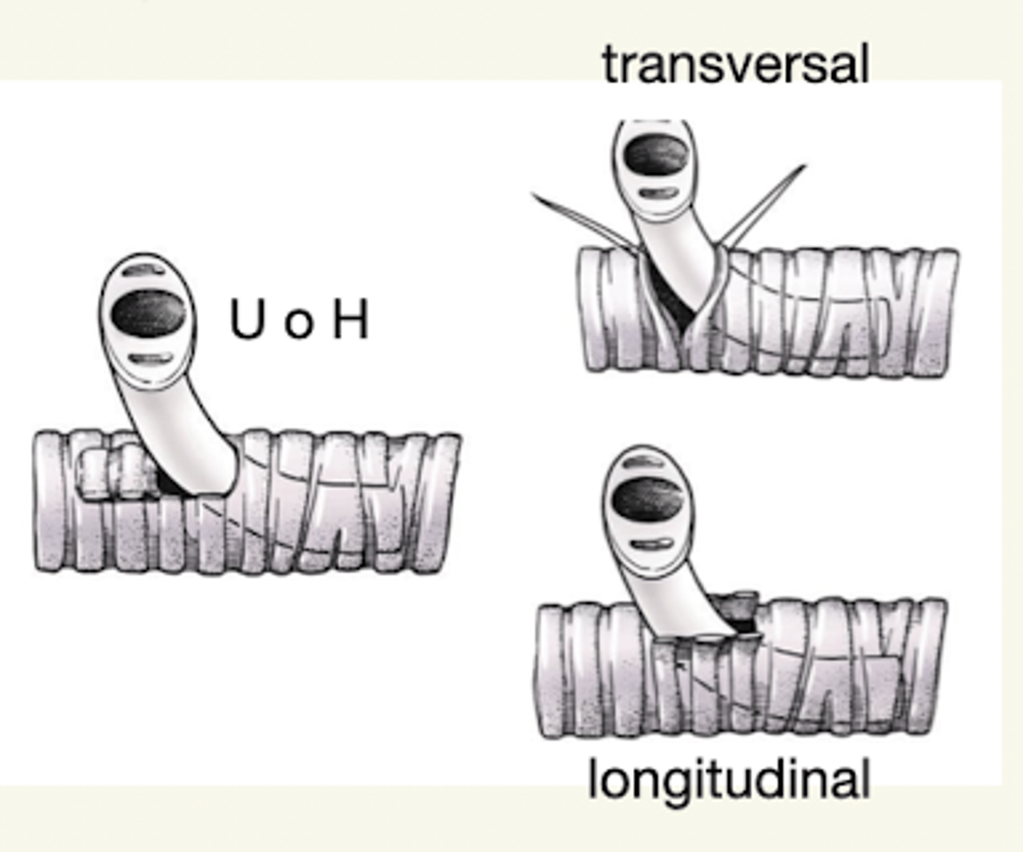 <p>transversal, longitudinal, en U o H</p>