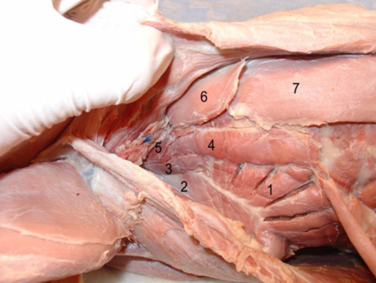 <p>what is indicated by 3, 4 & 5?</p>