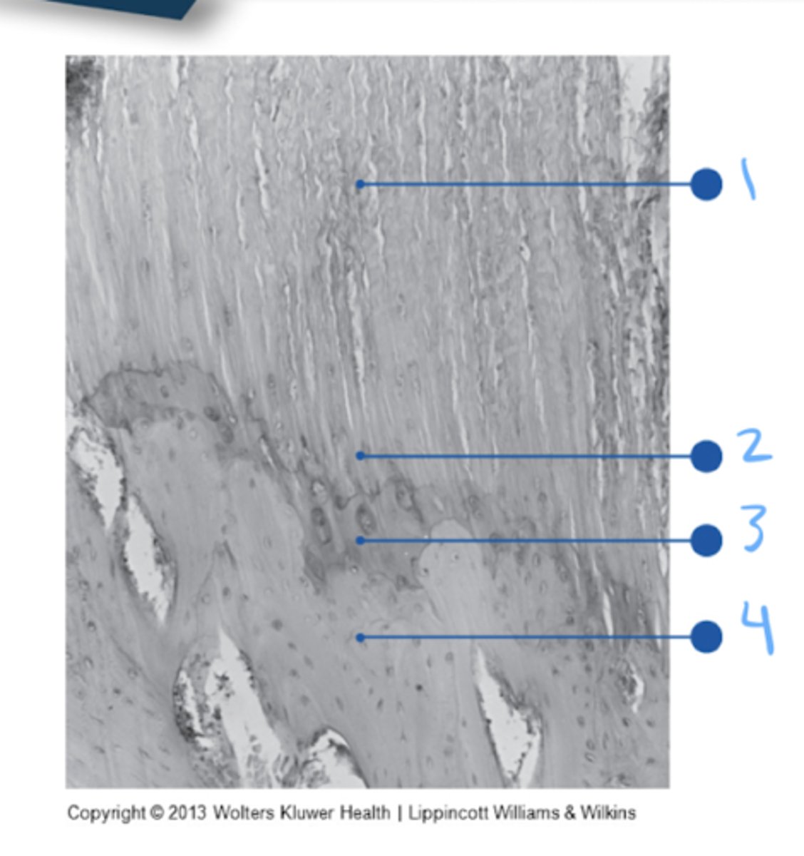<p>Zone 1: Collagen fibers</p><p>Zone 2: Fibrocartilage</p><p>Zone 3: Mineralized fibrocartilage</p><p>Zone 4: Cortical bone</p>