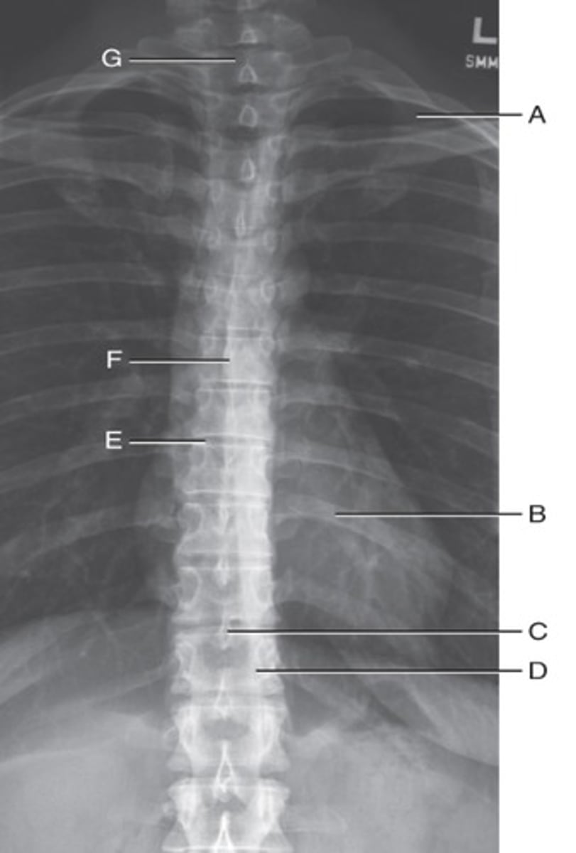 <p>Label the anatomy indicated by letter E:</p>