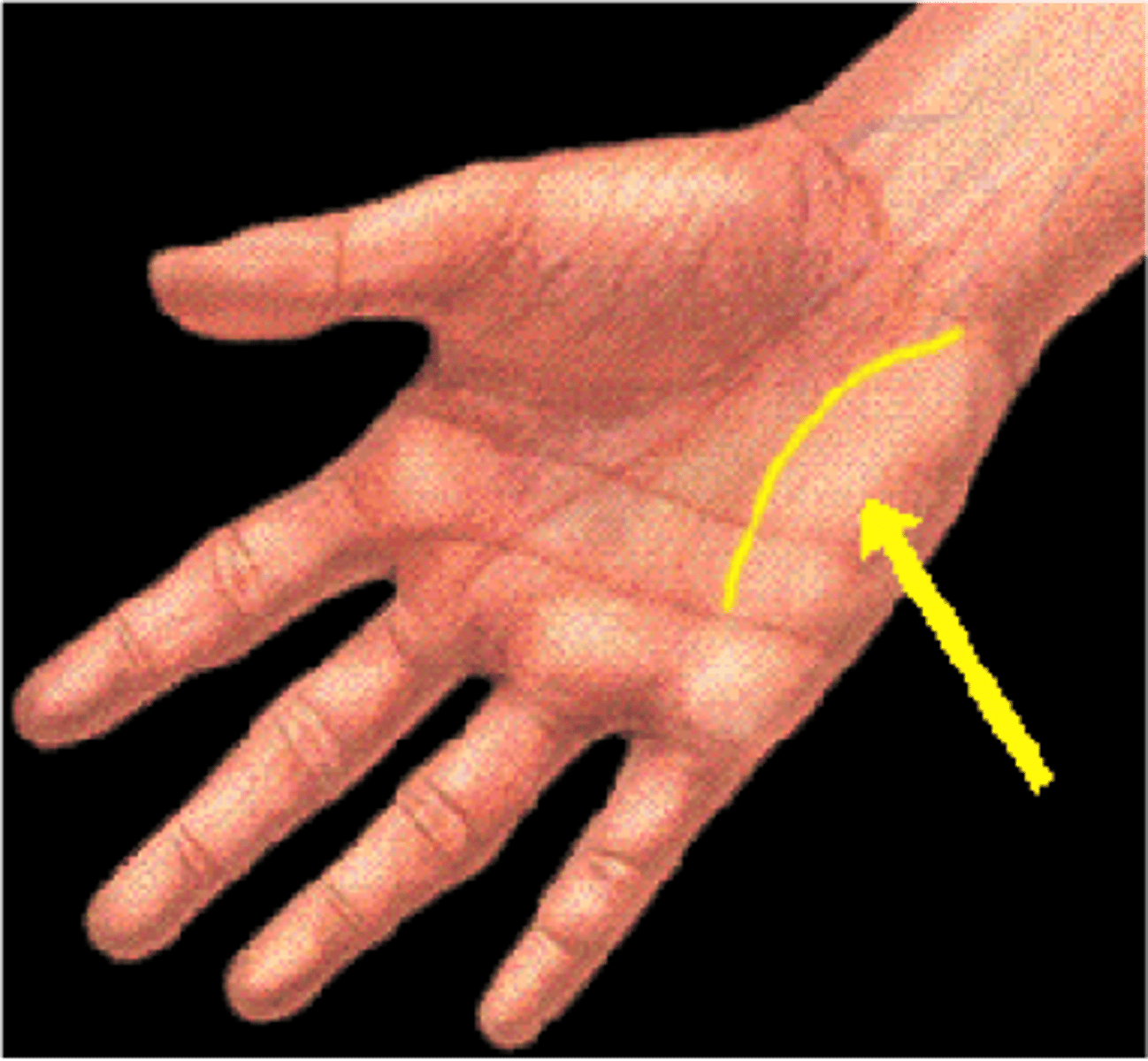 <p>opponens digiti minimi, abductor digiti minimi, flexor digiti minimi brevis.</p><p>All innervated by ulnar nerve.</p>