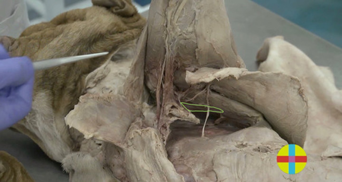 <p>Origen: fosa subescapular</p><p>Inserción: tubérculo menor del húmero</p><p>Función: extensor/flexor hombro, adductor, ligamento tensor contráctil (suple función lig colateral md)</p><p>Inervación: n. subescapulares</p><p>- &nbsp;Plano, triangular.</p>