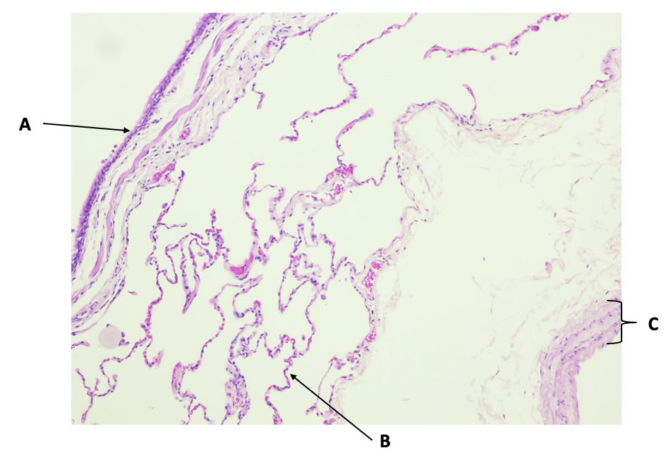 <p>Annotate the features of a normal lung</p>