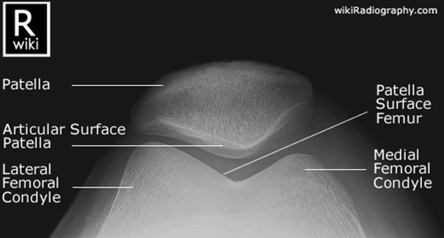 <p>SID: 115cm</p><p>Central ray: angled 15 degrees towards the knee (avoiding the toes)</p><p>Centring point: behind the patella</p>