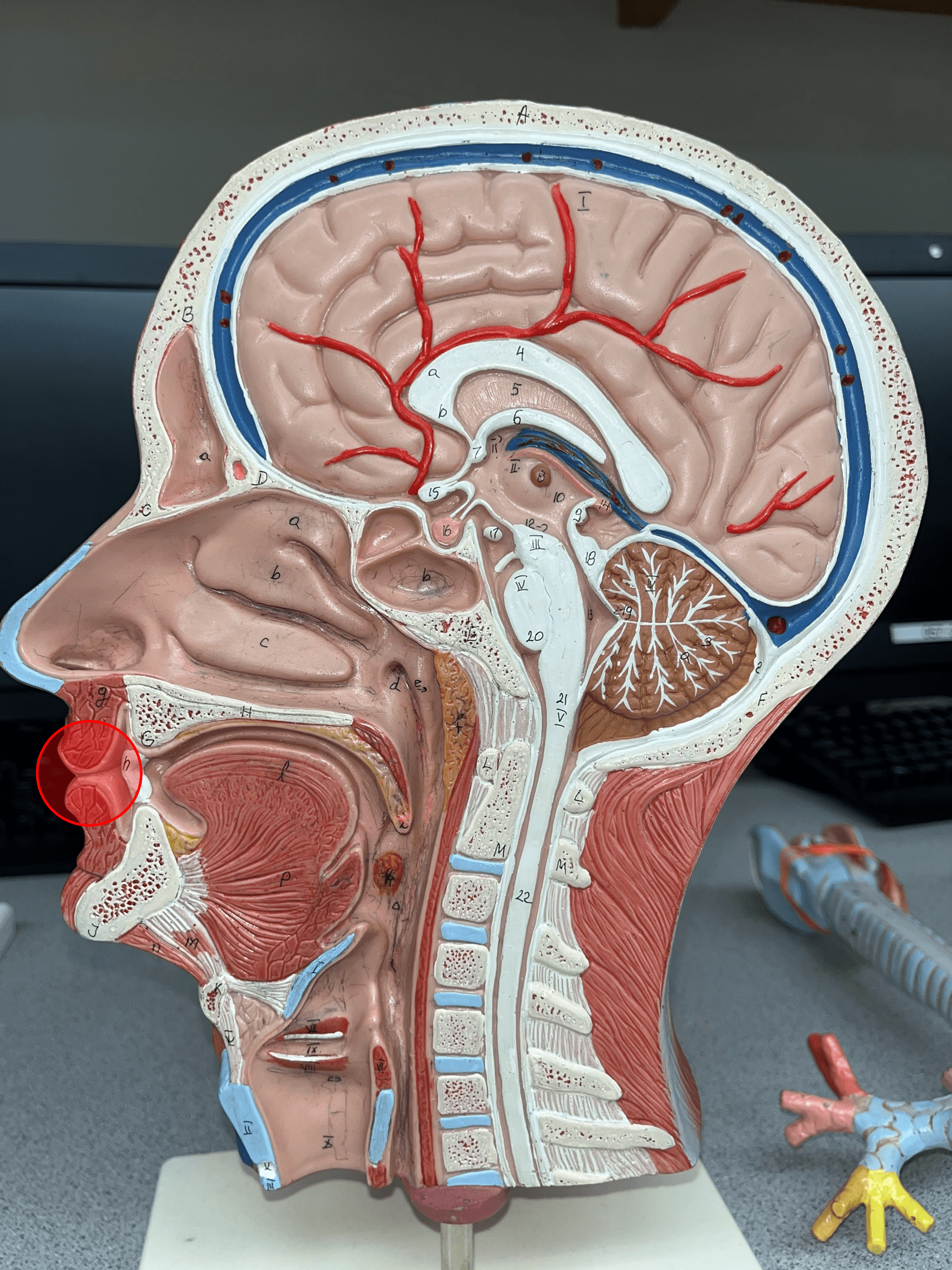 One of the anterior borders of the opening of the mouth.