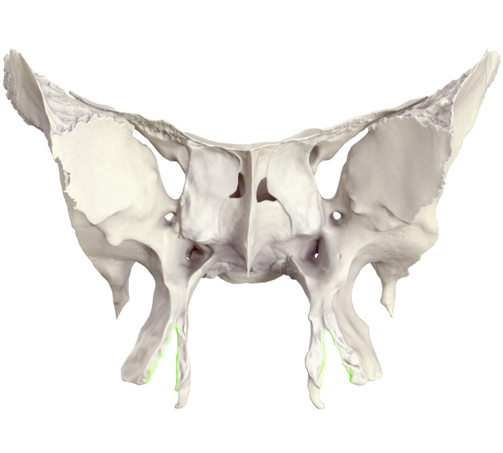 <p>röp bevágás</p>