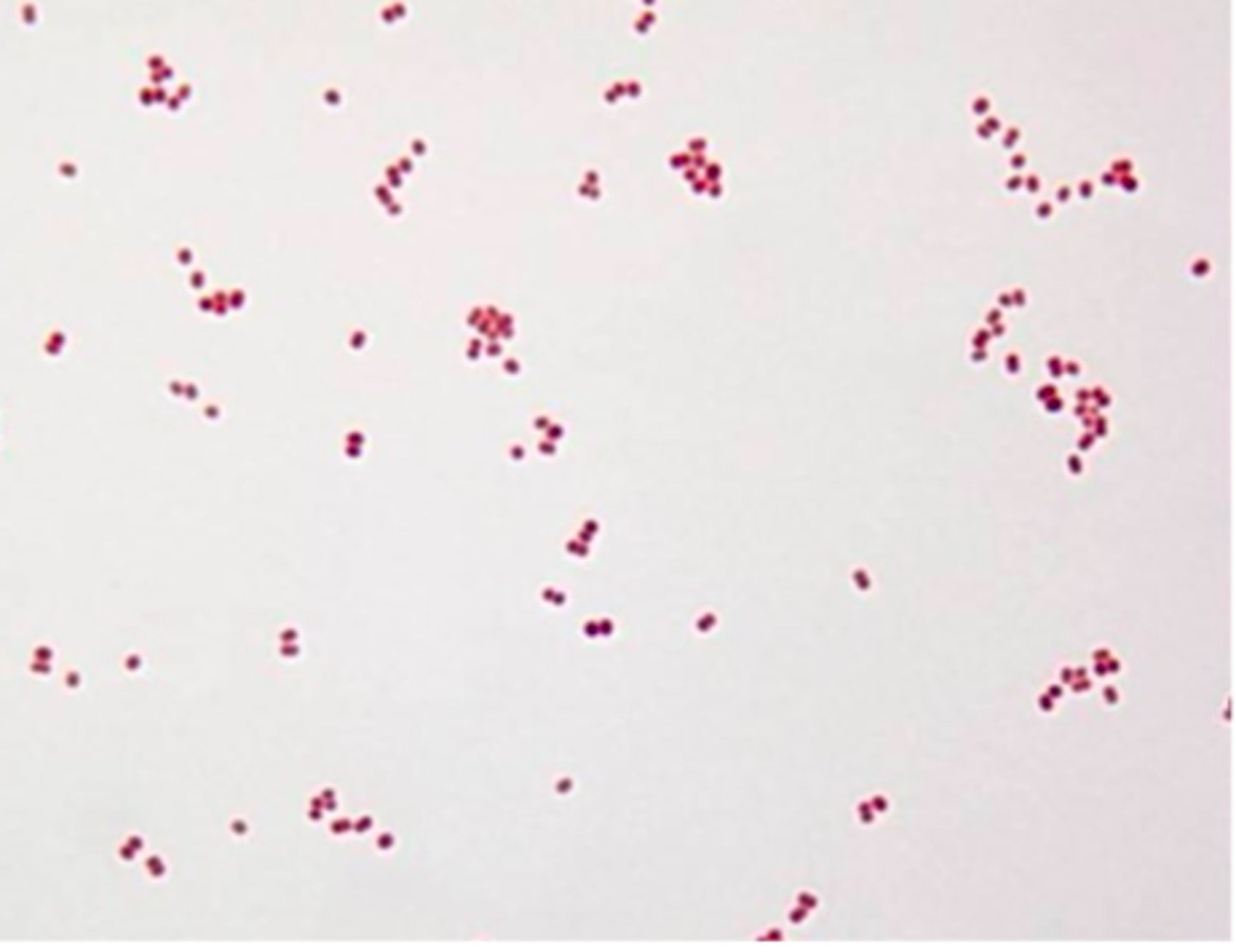 <p>The following image is an example of __________<br>a. diplococcus<br>b. staphylococcus<br>c. streptococcus<br>d. streptobacillus</p>