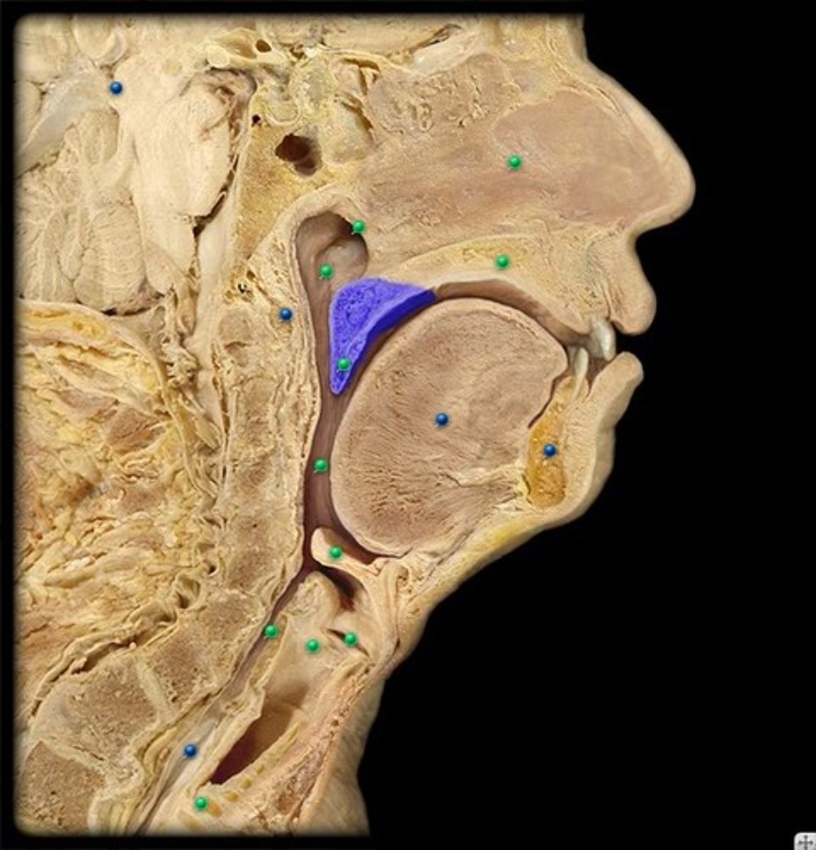 knowt flashcard image