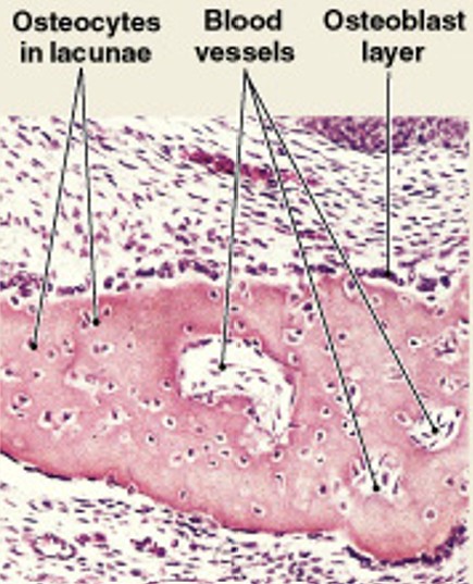 <p>Which step of intramembranous ossification have:</p><ul><li><p>Blood vessels grow into the area</p><ul><li><p>To supply the osteoblasts</p></li></ul></li><li><p><span style="color: yellow;"><strong>Spicules connect</strong></span></p><ul><li><p>Trapping blood vessels inside bone</p></li></ul></li></ul><p></p>