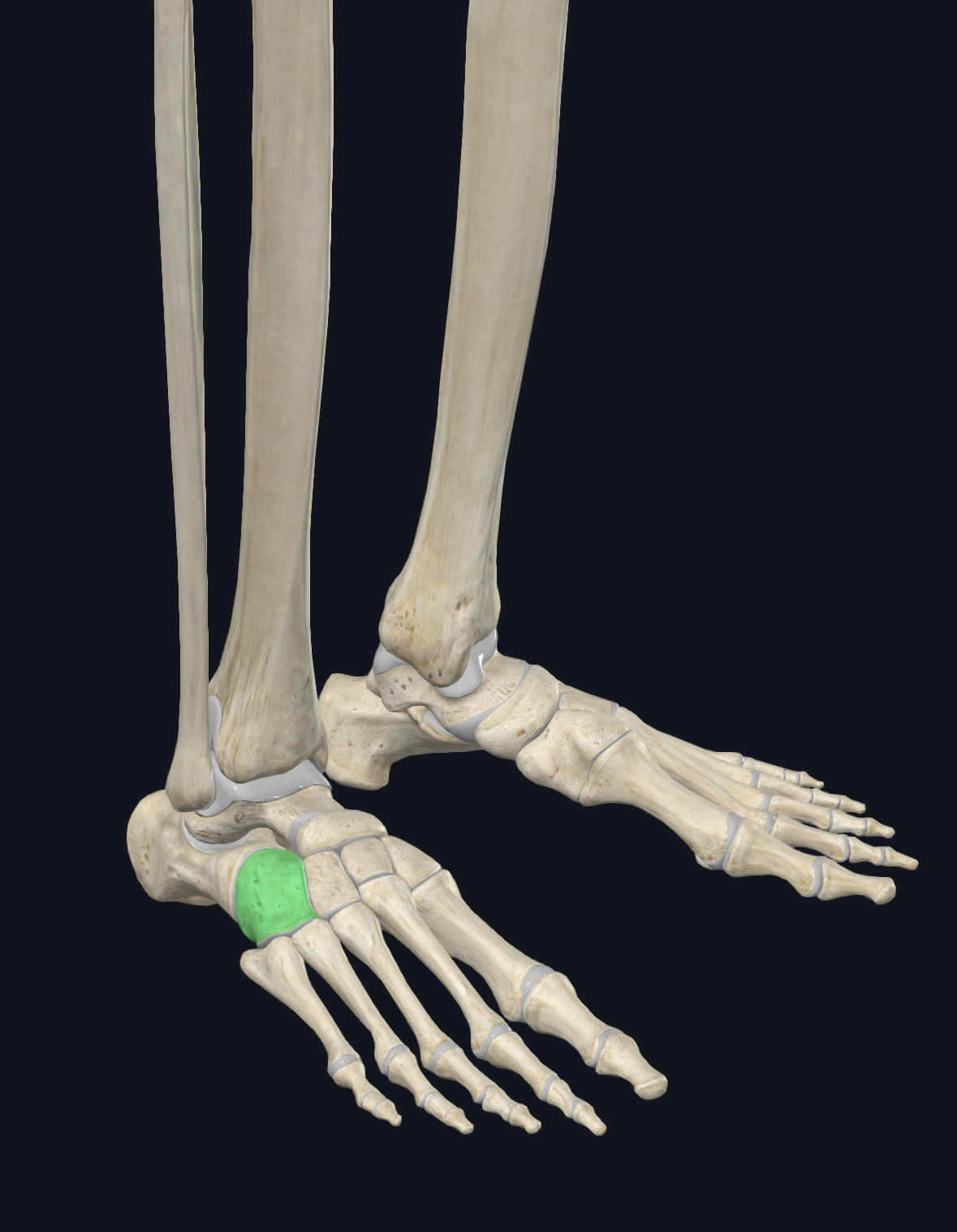 term image