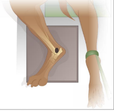 <p>Lateral recumbency with affected limb closest to xray plate </p><p>Remove overlying structures </p><p>Contralateral limb drawn caudally &amp; secured with rope/sandbag </p>