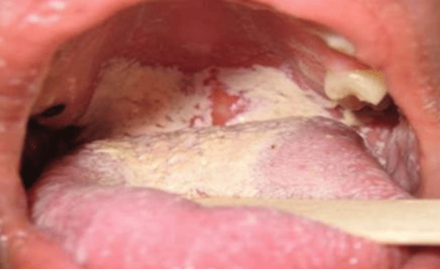 <p>What is the diagnosis?</p>