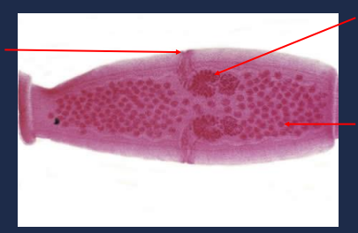 State the name of the lower right portion of the picture.