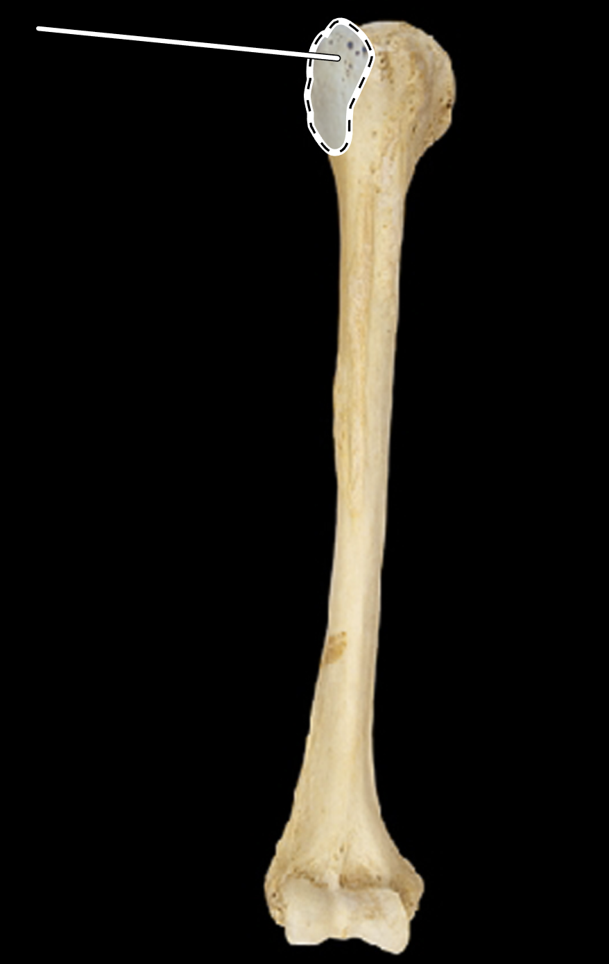 <p>Name the highlighted portion.</p><p>(Humerus, anterior view, right side).</p>