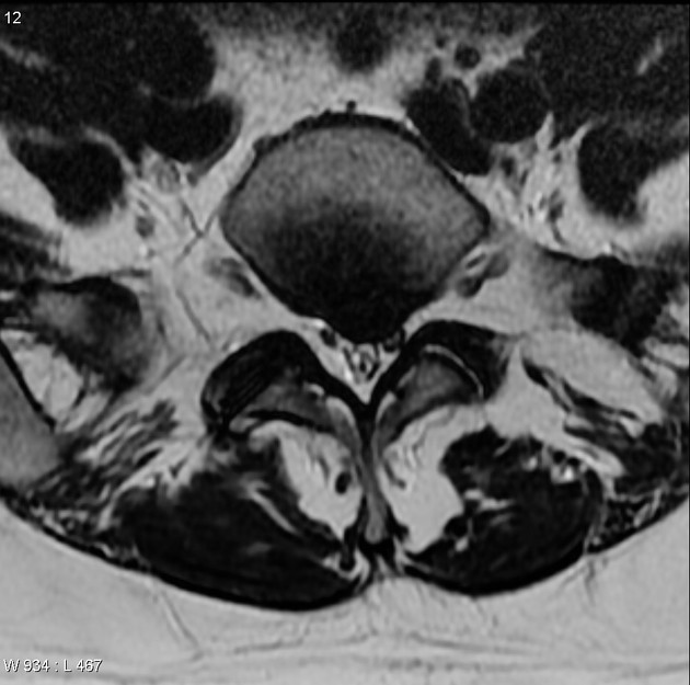 <p>Name this pathology. </p>