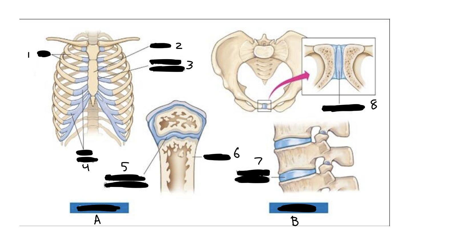 <ol><li><p>ribs</p></li><li><p>sternum</p></li><li><p>costosternal synchodrosis</p></li><li><p>costal cartilage</p></li><li><p>epiphyseal plate (hyaline cartilage)</p></li><li><p>long bone</p></li><li><p>vertebral disk (fibrocartilage)</p></li><li><p>symphysis pubis</p><p>A. synchondroses</p><p>B. symphyses</p></li></ol>
