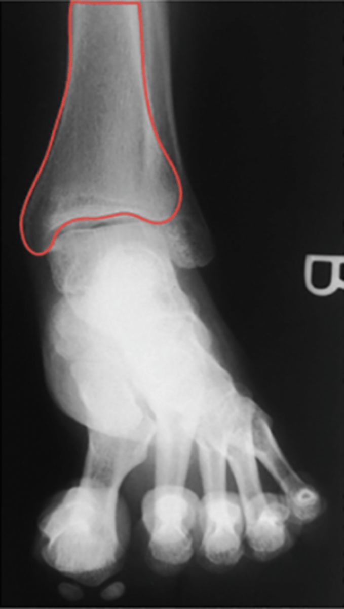 <p>What structure is highlighted?</p>