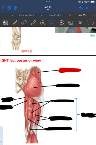 <p>What muscle is this?</p>