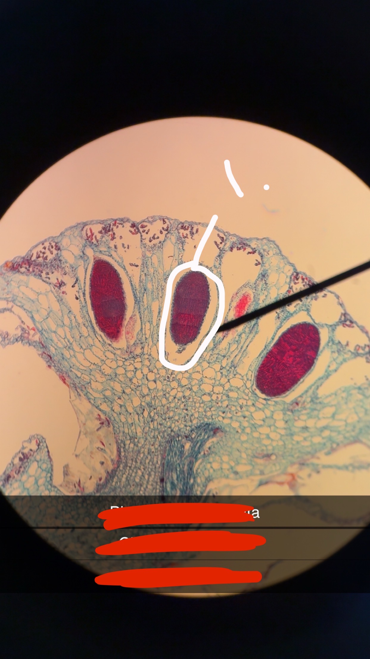 <p>What is inside the antheridium</p>
