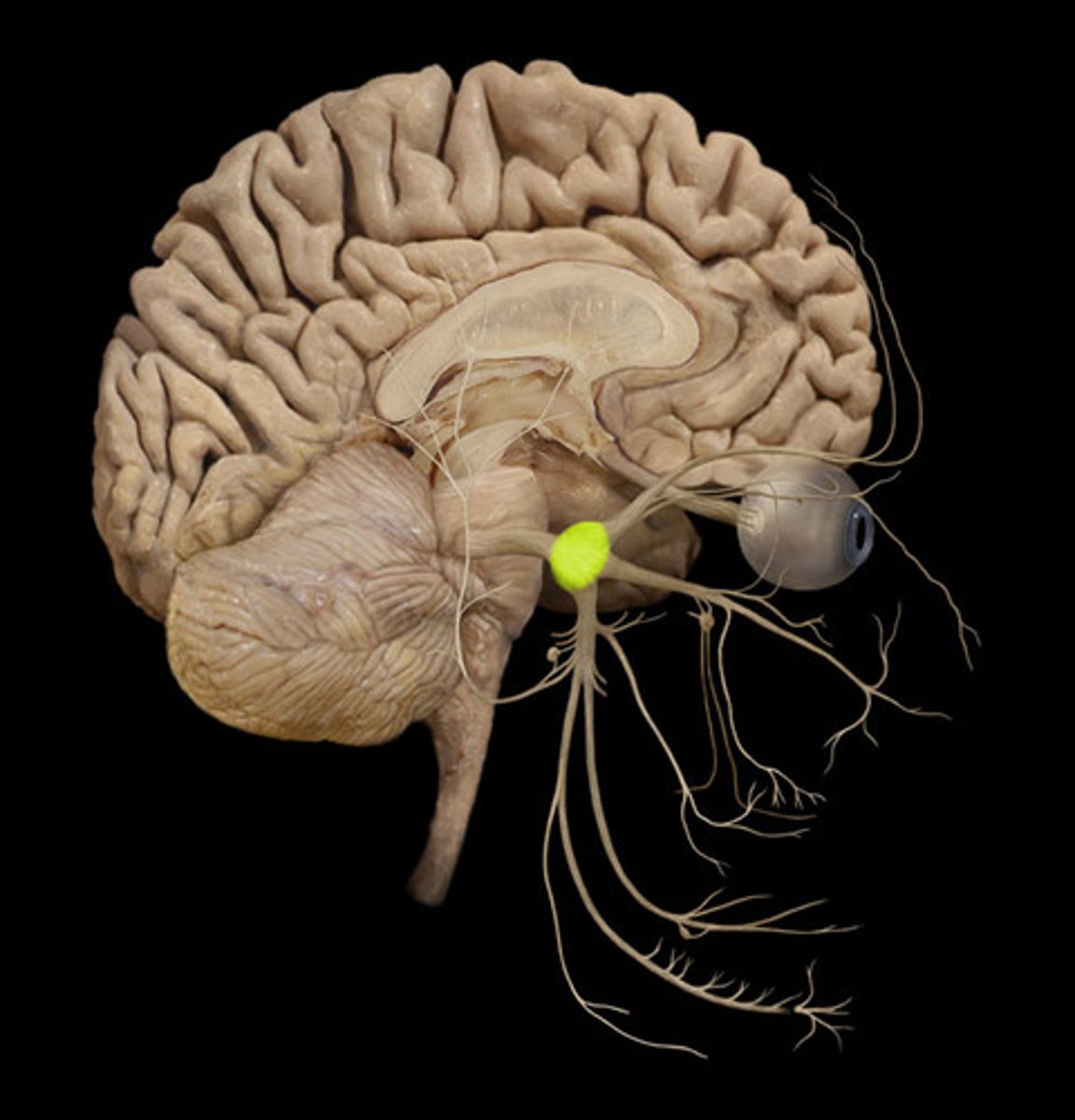 <p>sensory ganglion that contributes sensory fibers to the trigeminal nerve</p>