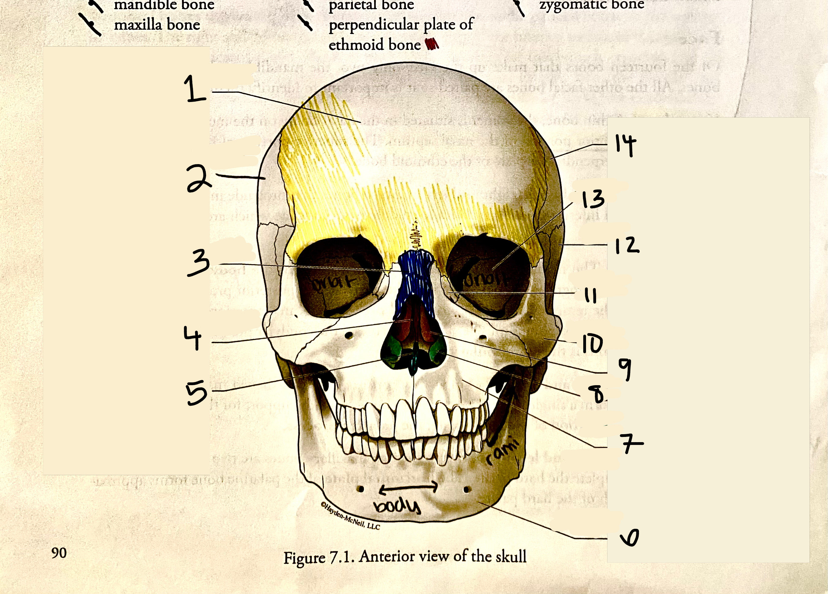 <p>Temporal Bone</p>