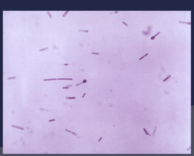 <p><span style="font-family: Arial, sans-serif">Clostridium tetani</span></p>