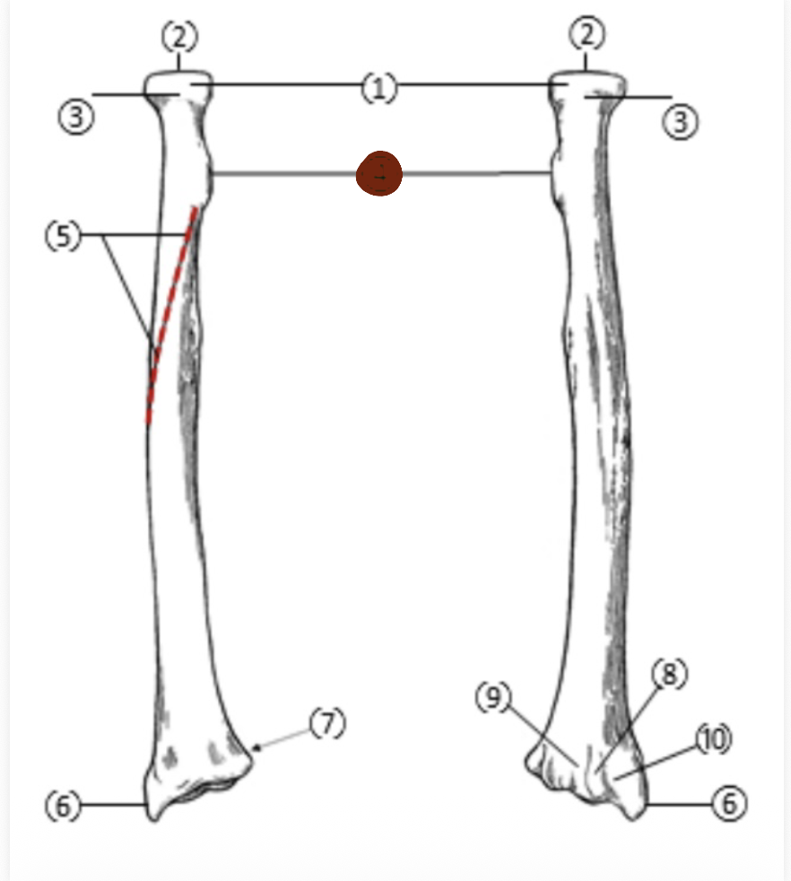 <p>On the Proximal end of the radius, which part is highlighted (4)?</p>