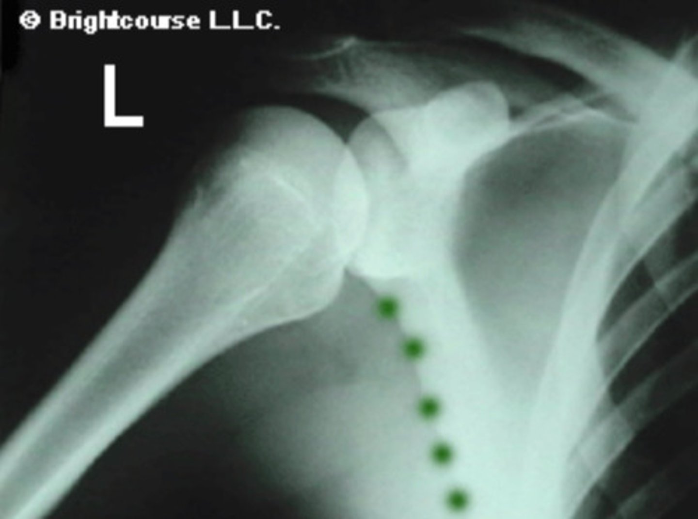 <p>What is being identified in this image?</p>