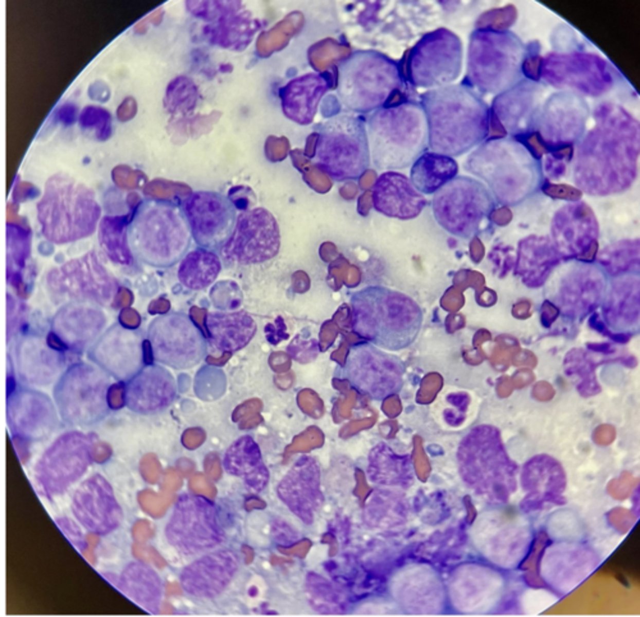 <p>What malignancy characteristics are present?</p>