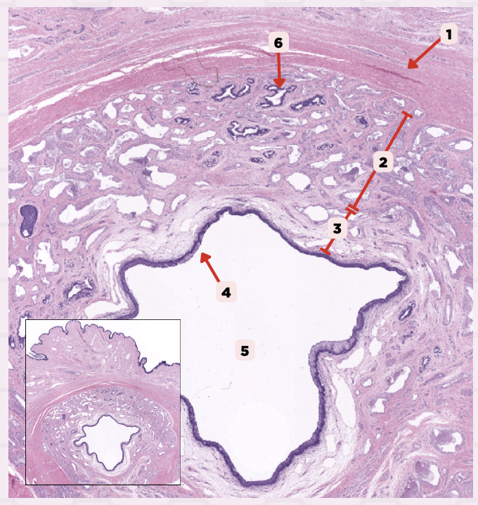 <p>Identify the structure labeled as 2.</p>