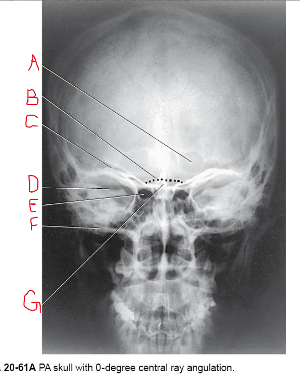 <p>A B &amp; C</p>