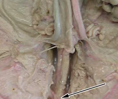 <p>What is the arrow pointing to? What’s it function? </p>