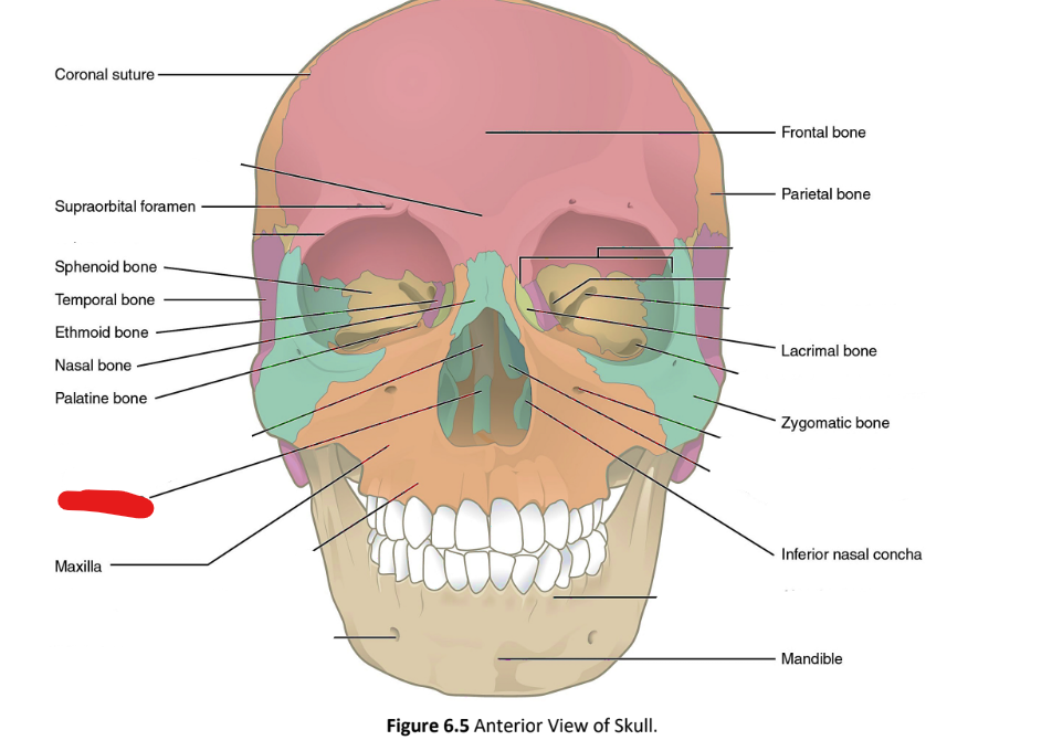 term image